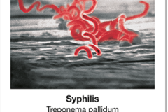 Seuchen_01_Syphilis
