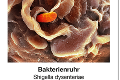 Seuchen2_02_Bakterienruhr